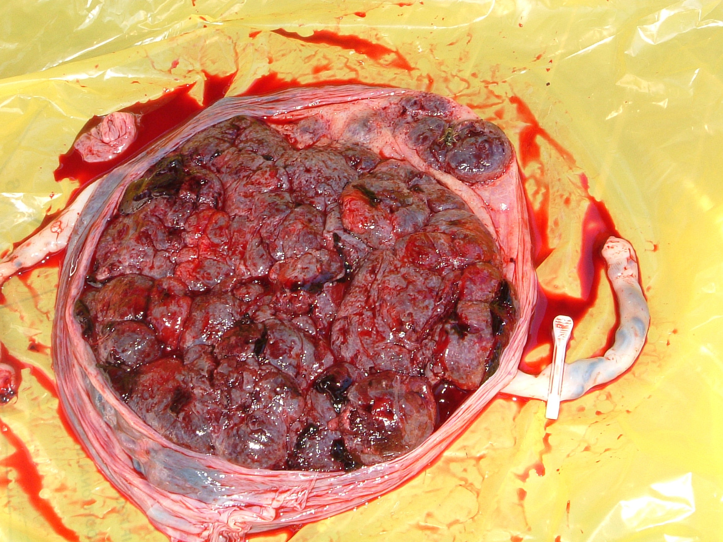 http://midwifemuse.files.wordpress.com/2007/11/inside-a-placenta.jpg